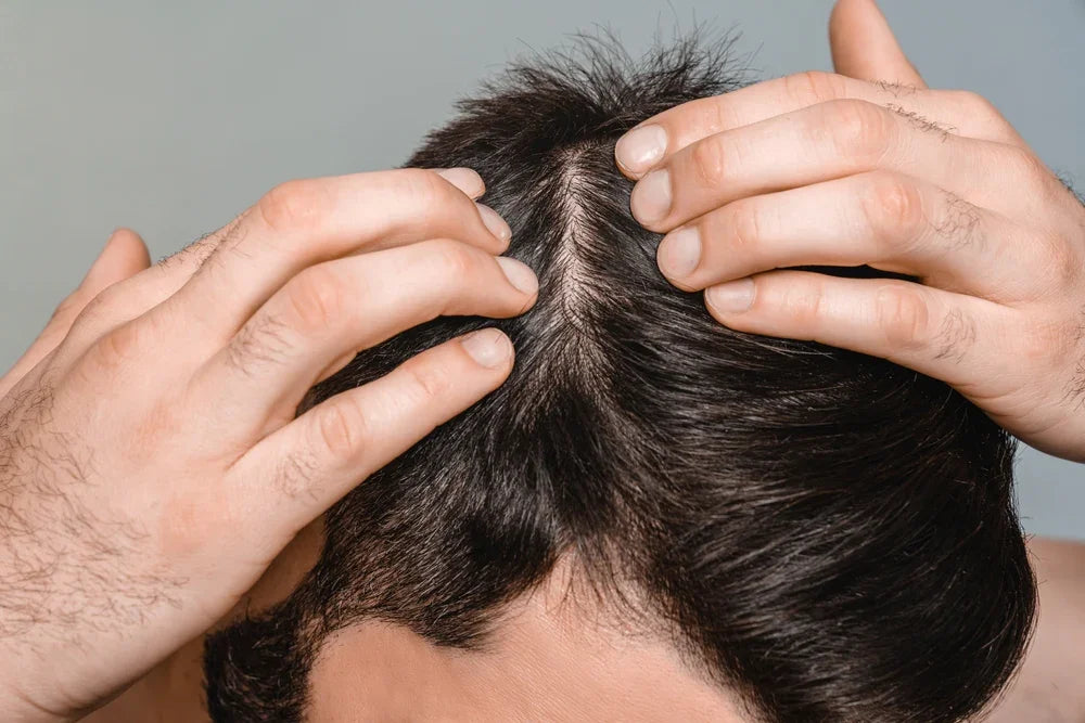 Person examining their scalp with hands on a gray background